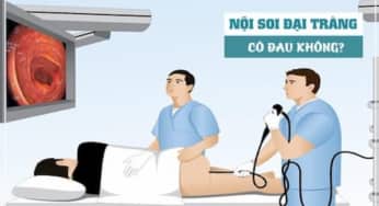 Những điều cần biết khi nội soi đại trực tràng