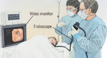 Các bước nội soi dạ dày và những điều cần lưu ý