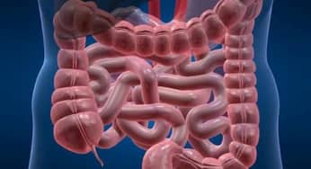 Phân biệt mức độ nguy hiểm của các bệnh đại tràng