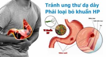 Khuẩn HP nguy hiểm như thế nào?