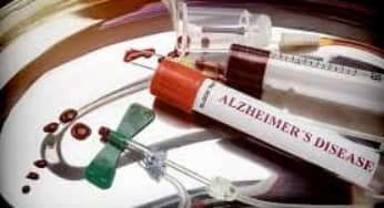 Xét nghiệm máu phát hiện bệnh Alzheimer sớm chính xác 94%