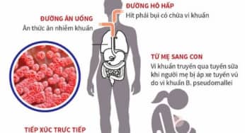 Điều trị bệnh Whitmore vẫn có nguy cơ thất bại cao vì sao?
