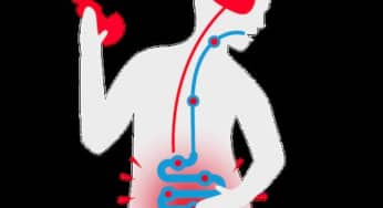 Nghiên cứu mới về điều trị hội chứng ruột kích thích với chế độ ăn kiêng FODMAP thấp