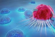 Protein gây kháng hóa trị ở một số bệnh ung thư