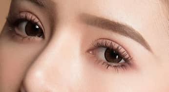 Cắt mí: Một số vấn đề bạn cần phải quan tâm