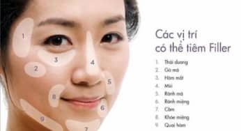 Kỹ thuật tiêm filler chuẩn, điều kiện đối với bác sĩ thực hiện