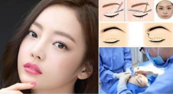 Phẫu thuật cắt mí mắt, Lưu ý biến chứng và tác dụng phụ