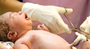 Các câu hỏi thường gặp về tế bào gốc, máu cuống rốn