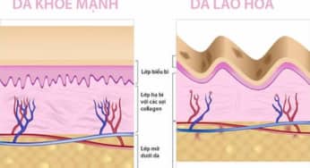 Cấu trúc da và nguyên nhân lão hóa sớm