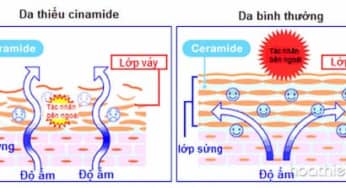 Ceramide thành phần thiết yếu trong mỹ phẩm giúp đẹp da như thế nào?