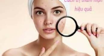 Hiểu để trị mụn, vết thâm hiệu quả