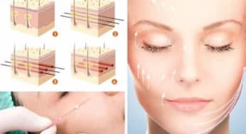 Những triệu chứng, lưu ý sau khi căng da mặt bạn nên biết