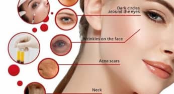 Ưu, nhược điểm của công nghệ tế bào PRP trong làm đẹp