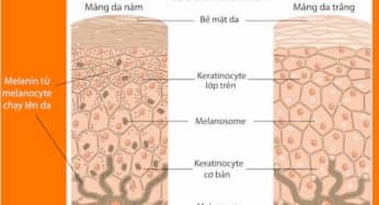 Một số câu hỏi về Melanin, nhân tố hình thành nám, tàn nhang