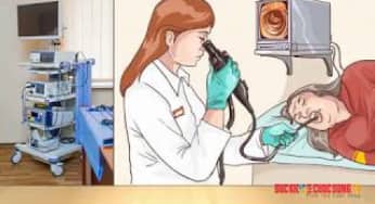 Video Nội soi thực quản – dạ dày – tá tràng gây mê và không gây mê