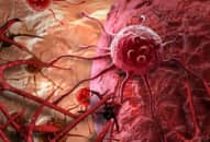 Sự khác biệt giữa tế bào ung thư kỳ quái và tế bào bình thường