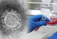 5 thuốc điều trị Sars-coV-2 (corona virus) chủng mới được Hàn Quốc cấp phép thử nghiệm
