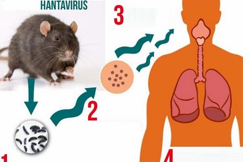 Hanta Virus: triệu chứng, nguồn gốc, cơ chế gây bệnh, phòng và điều trị
