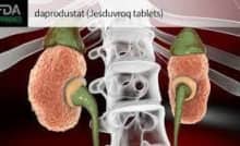 FDA chấp thuận Jesduvroq điều trị thiếu máu do bệnh thận mạn tính