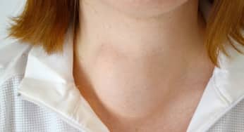 <strong>Bệnh bướu cổ gia tăng bất thường ở phụ nữ và giải pháp</strong>