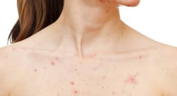 Bệnh da liễu thường gặp: nguyên nhân, triệu chứng, thói quen sinh hoạt gây bệnh