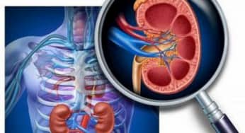 MỘT SỐ LƯU Ý VỀ ĐIỀU TRỊ BỆNH THẬN IgA