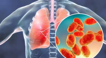 Các loại áp xe phổi: nguyên nhân, triệu chứng, các giai đoạn của áp xe phổi