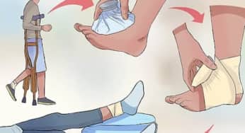 Cách sơ cứu nhanh khi bị bong gân