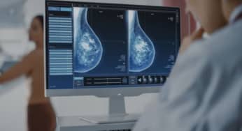 Camizestrant, thuốc mới đột phá điều trị ung thư vú
