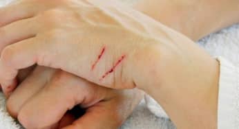 <strong>Cảnh báo những nguy cơ dẫn đến uốn ván</strong>