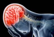 Chấn động não: Triệu chứng chấn động, dấu hiệu cần cấp cứu