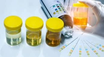 Chẩn đoán và điều trị nhiễm trùng đường tiết niệu