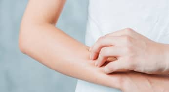 Dị ứng: những điều nên biết