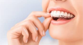 Độ tuổi tốt nhất để chỉnh nha