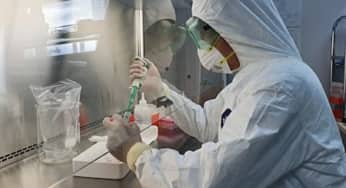 Giá trị của các kỹ thuật xét nghiệm phát hiện corona virus (Sars-coV-2)