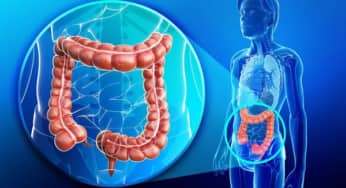 Giải pháp phòng ung thư đại trực tràng gia tăng