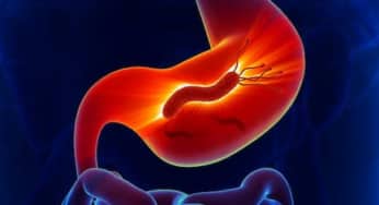 Hướng dẫn điều trị diệt helicobacter Pylori (Hp)