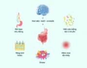 Hội chứng ruột kích thịch (IBS) góc nhìn mới từ trục não ruột