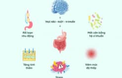 Hội chứng ruột kích thịch (IBS) góc nhìn mới từ trục não ruột