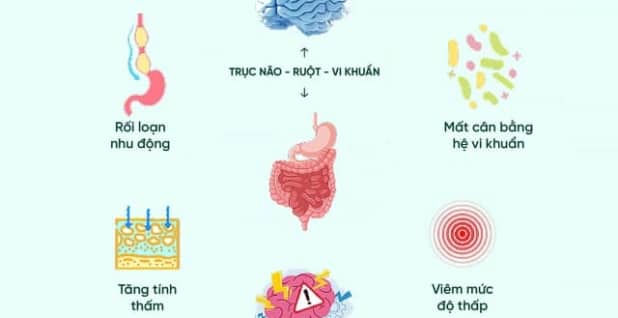 Hội chứng ruột kích thịch (IBS) góc nhìn mới từ trục não ruột
