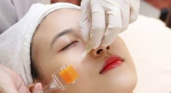 Loại da không nên sử dụng phương pháp lăn kim và những cẩn trọng nên biết