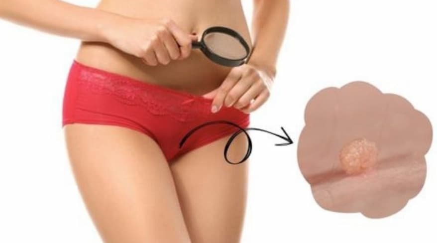 Mặc Đồ Lót Sai Cách: Những Sai Lầm "Thầm Kín" Gây Hại Sức Khỏe Phụ Nữ Mà Ít Ai Ngờ Tới