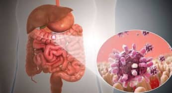 Mối liên hệ giữa bệnh viêm ruột và tổn thương ở khớp