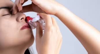 Ngửa đầu ra sau khi bị chảy máu cam: Quan niệm sai lầm tai hại