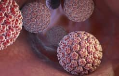 Người cây căn bệnh da liễu kỳ lạ