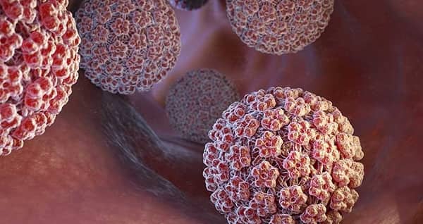 Người cây căn bệnh da liễu kỳ lạ