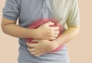 Nguy cơ mắc vảy nến cao gấp 8 lần đối với người  mắc bệnh Crohn