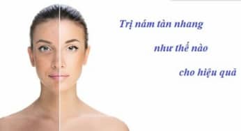 Nguyên tắc vàng để điều trị nám