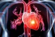 Những dấu hiệu cảnh báo bệnh tim mạch, nguyên nhân tử vong hàng đầu