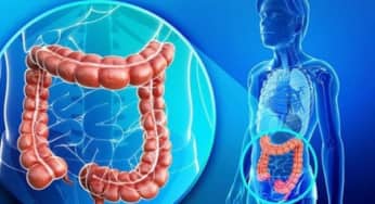 Những gì bạn không biết về Hội chứng ruột kích thích